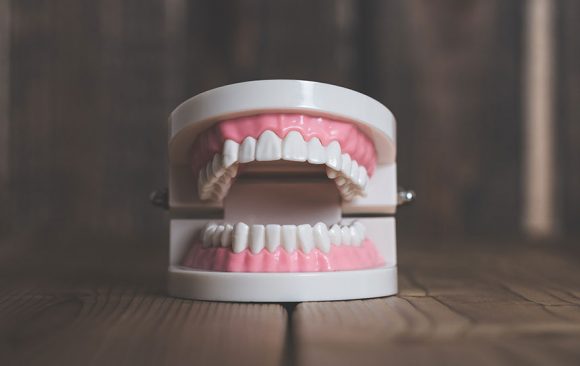 Missing Teeth – What Do I Do Now? Missing Teeth – What Do I Do Now?