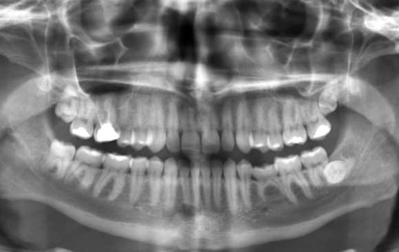 The Importance of Dental X-rays: Insights from Your Barrie Dentist