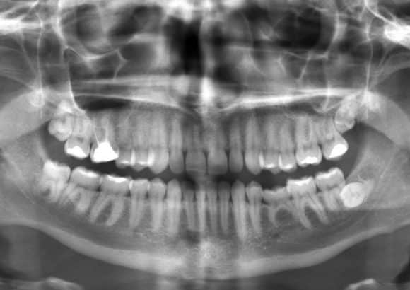 The Importance of Dental X-rays: Insights from Your Barrie Dentist