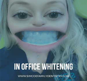 Teeth Whitening