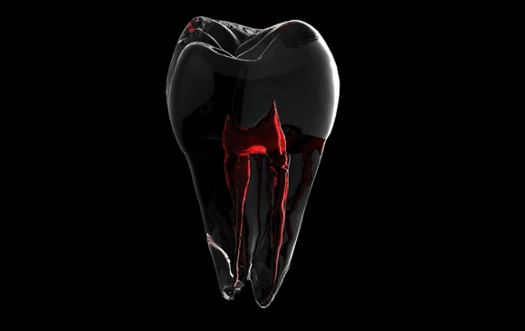 What Can I Expect During a Root Canal? What Can I Expect During a Root Canal?