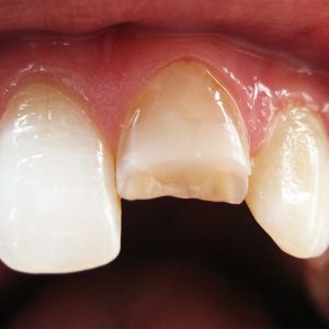 The Covid-19 Pandemic:  Hard on your Teeth!