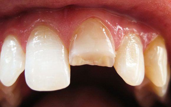 The Covid-19 Pandemic: Hard on your Teeth! The Covid-19 Pandemic: Hard on your Teeth!