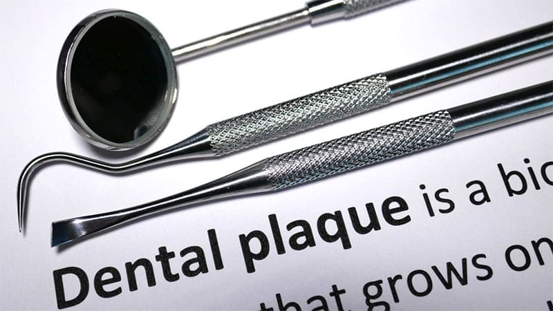 Plaque vs. tartar: Differences, formation, and more