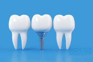 Dental Implant Surgery
